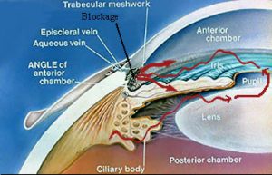 Glaucoma - Davidson Eye Associates